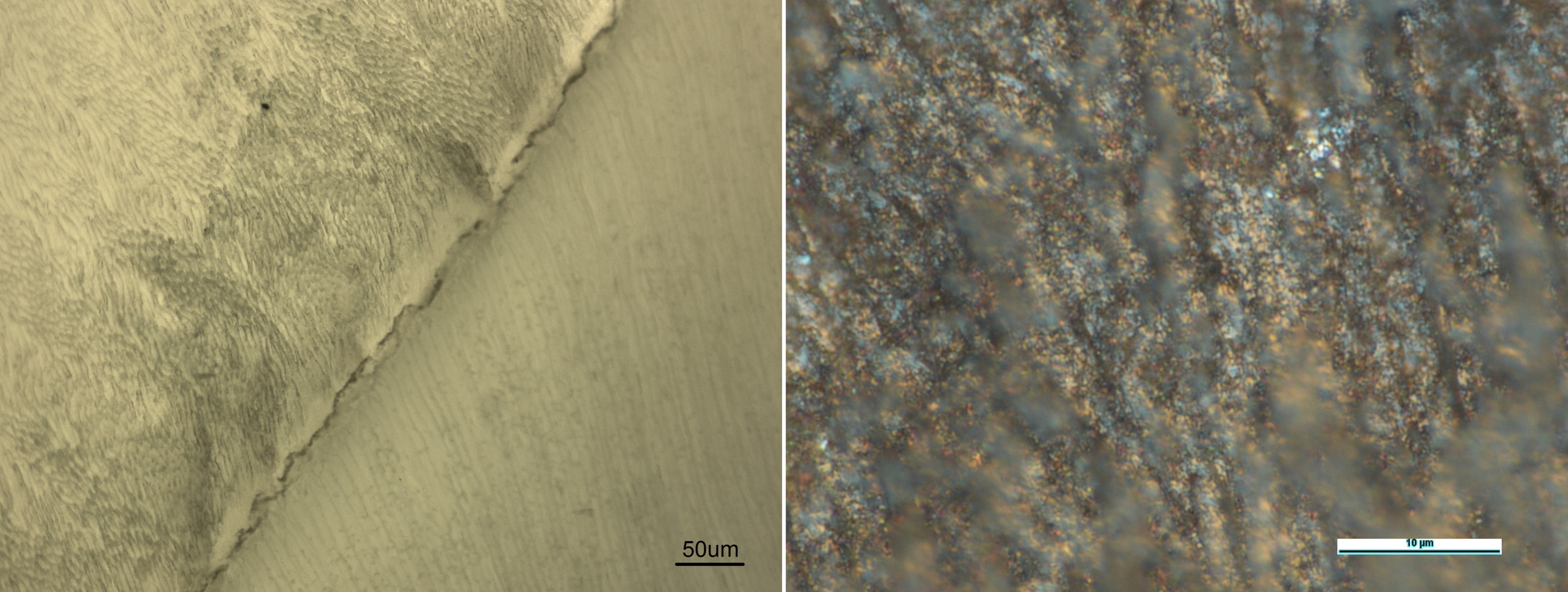 Слева: участок дентино-эмалевой границы со сформированным биомиметическим антимикробным покрытием на поверхности, увеличение х600; справа: Участок эмали зуба с нанесенным биомиметическим антимикробным покрытием на поверхности зубной эмали в области эмалевых стержней, увеличение х1000. Источник: Павел Середин